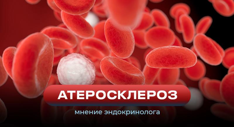 Профилактика атеросклероза