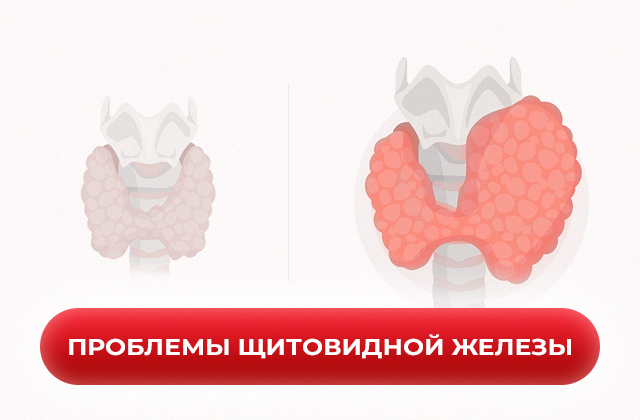 Проблемы щитовидной железы и их влияние на общее здоровье и метаболизм
