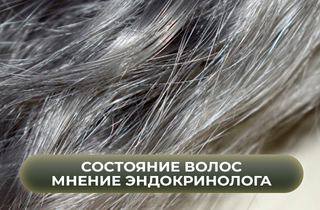Состояние волос как показатель здоровья. Мнение врача-эндокринолога